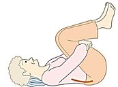 車禍椎間盤突出　青年痛到歪腰