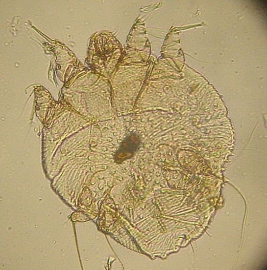 顯微鏡下的疥蟲（圖／維基百科）