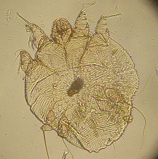 顯微鏡下的疥蟲（圖／維基百科）