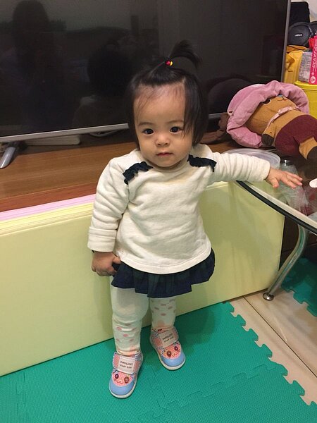 滿週歲的娜娜。(好醫師新聞網)