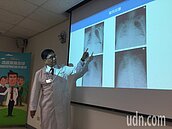 流感住院年輕化　醫院統計平均年齡少8歲