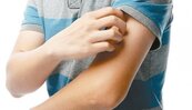 麻疹再增兩例　延誤通報恐違法