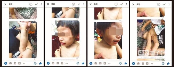 新竹市一名3歲男童父母離異，卻遭生父嚴重虐待，不僅骨瘦如柴、四肢有瘀傷，其生父還以束帶將他綁在陽台上，男童生母察覺不對勁案情才終於曝光。（摘自爆料公社臉書）