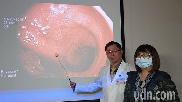 高姓婚紗女業務主管（右）經接受生物製劑治療，搭配調整飲食與心態，終於揮別「廁所」人生。記者趙容萱／攝影 