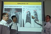 退休後才發現職業病　醫院聯手協助職傷給付
