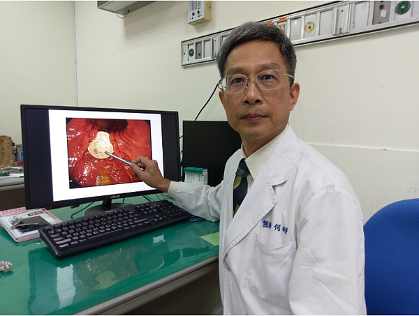 衛福部豐原醫院醫師說明 男童誤吞硬幣地方。圖/衛福部豐原醫院提供