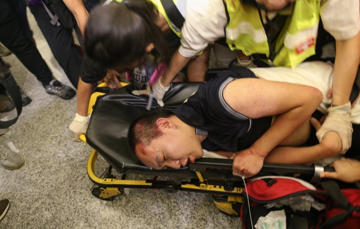 環球網記者付國豪遭圍困毆打,隨後被警方救出並送往醫院。 歐新社