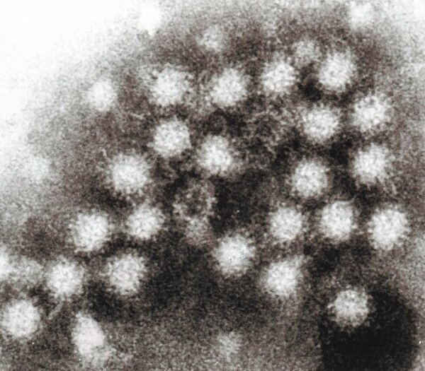 疾管署指出，諾羅病毒所有年齡層均可能被感染，傳染力強。圖／摘自維基百科