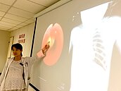 花生米卡氣管　3歲女童成植物人