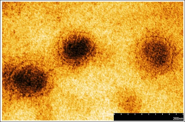 長庚團隊與國防醫學院預防醫學研究所合作電子顯微鏡下的新冠病毒影像。圖/長庚醫院提供