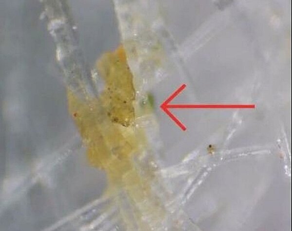 把使用過的口罩在顯微鏡下放大到2000倍,可以看到口罩上面正在移動的細菌。圖/健康時報