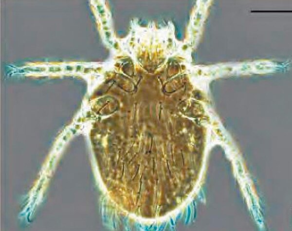 肉眼無法看到的恙,叮咬後會導致恙蟲病。圖/台東縣衛生局提供