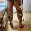 4根手指無知覺！　館長再曝腿腫「兩倍雞腿」照