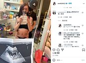 變性網紅罔腰自曝懷孕　衛生局明發函要求7天內陳述意見