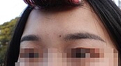 飄霧眉不滿意眉型？　小心雷射「洗眉」愈洗愈黑