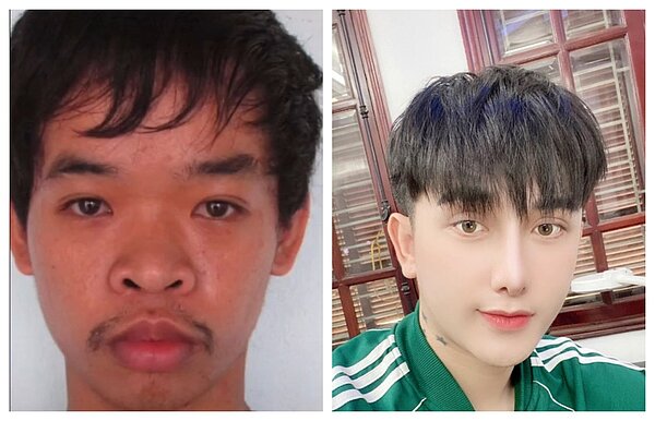 越南一名男子因天生長得醜導致求職屢屢碰壁,於是他砸錢整形變身花美男。圖擷自抖音@quyen_do8