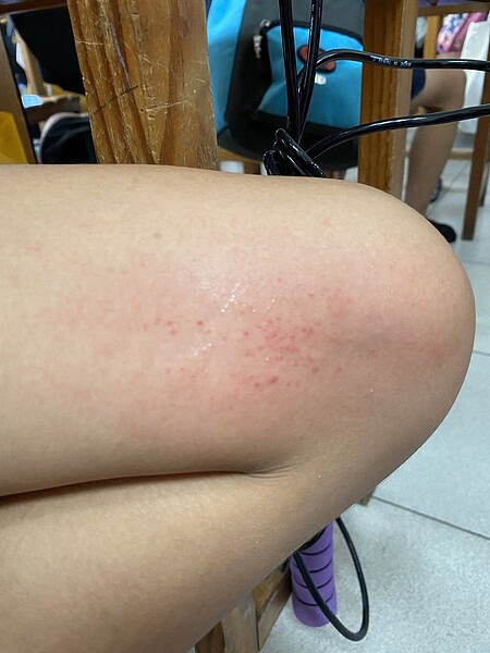 學校午餐供應甜桃,疑是表皮絨毛造成學生過敏。圖/校方提供