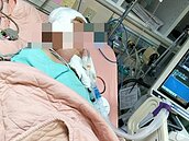男子遭撞腦傷半身失知覺　菲籍妻哭喊要賣房救丈夫