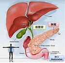 唐慧琳胰癌早逝　醫師：高危險群可這樣揪出早期病變