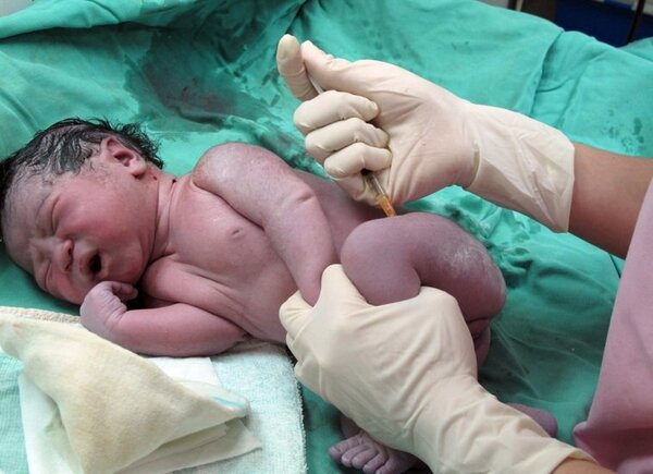 109年我國活產嬰兒出生數為16.2萬人，剖腹產率37.2％，遠高於世界衛生組織（WHO）建議的10%～15%。圖／聯合報系資料照