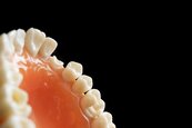 台中市學童蛀牙率六都最高　平均3.2顆爛牙