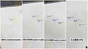 醫師寫字演化史曝光！他揭「年輕→主治」字跡變醜原因