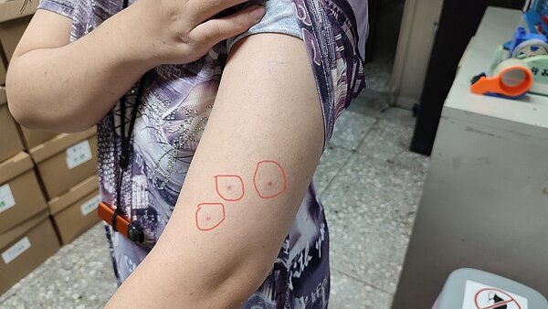 受害者呈三顆線狀或三角形排列的咬痕。圖/動保處提供