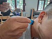 殘酷虐待！棒球教練以「炮烙之刑」燙傷球員