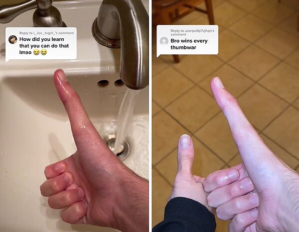 男子有著長達12.7公分的拇指,自稱從來沒輸過拇指摔角。圖擷自TikTok