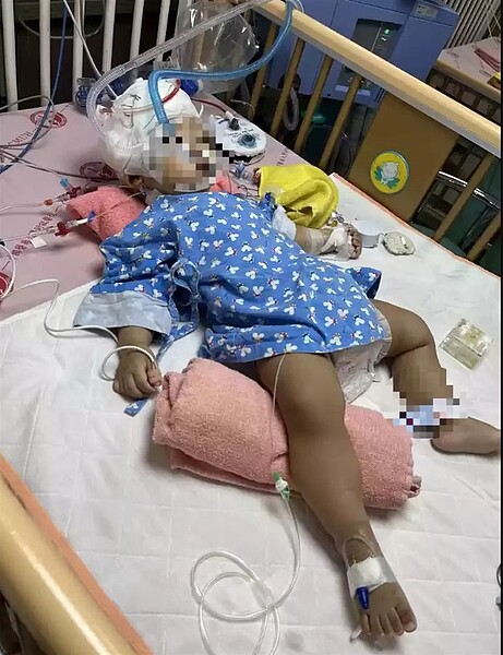 何男的兒子剛滿周歲,因11月6發生車禍住進加護病房,身上插滿管線。圖/何先生提供