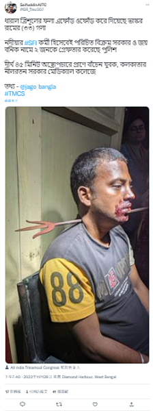 印度一名32歲男子拉姆(Bhaskar Ram)在工作場合與同事發生爭吵,同事一氣之下,竟拿起一把有150年歷史的三叉戟刺穿他的脖子。圖/翻攝自推特