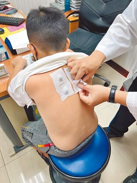 
夏至是三伏貼的季節，中醫師提醒，若有發燒、感冒等先暫時不要貼，另外出現皮膚紅疹過敏者，可先撕除，避免過度刺激皮膚。（鄭郁蓁攝）
