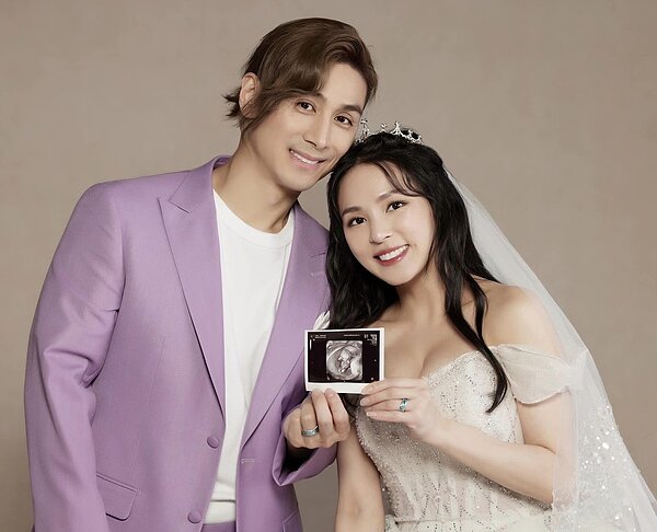 熊熊（右）和老公曬超音波照片。圖／摘自IG