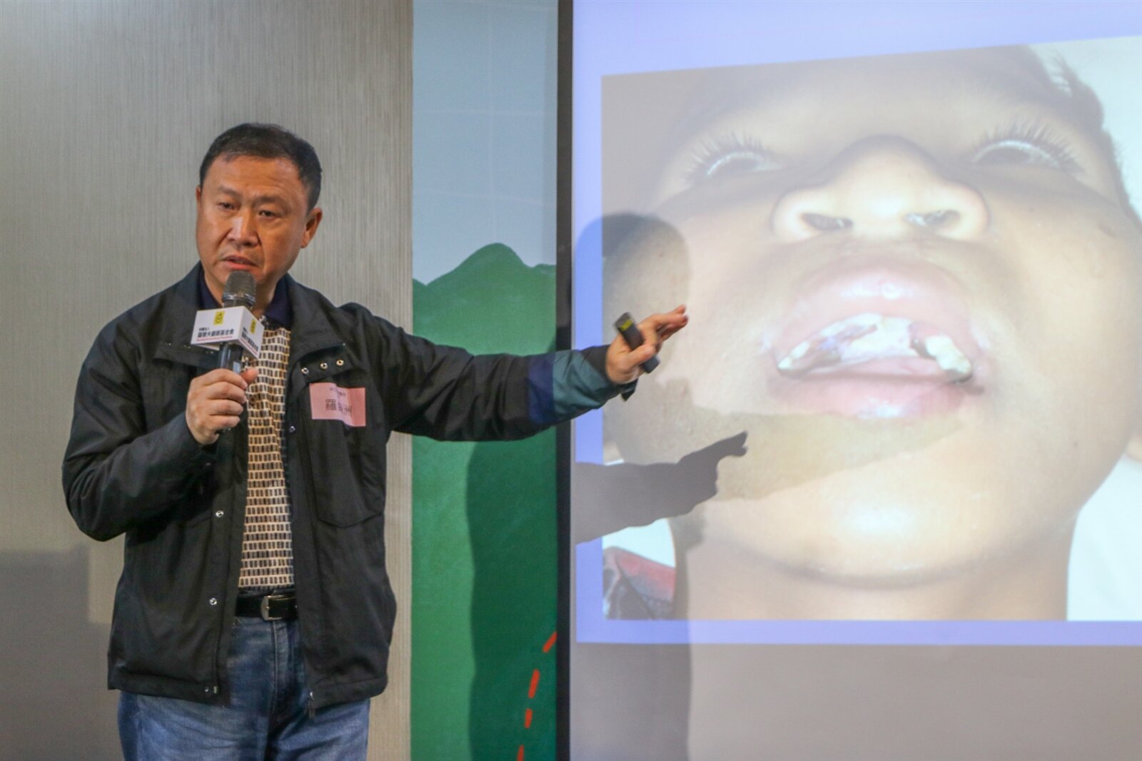 林口長庚醫院顱顏中心主治醫師羅綸洲表示，患有唇顎裂的小朋友，最好的治療時間是在滿周歲前。記者賴昀岫／攝影 