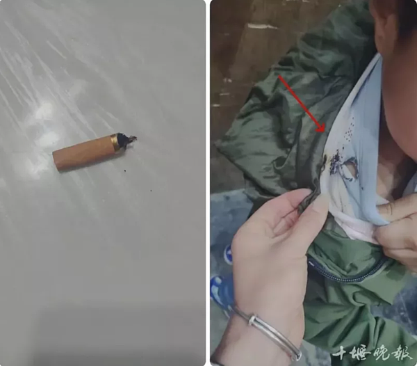 6歲男童的衣服被菸頭燒破。(取材自十堰晚報)