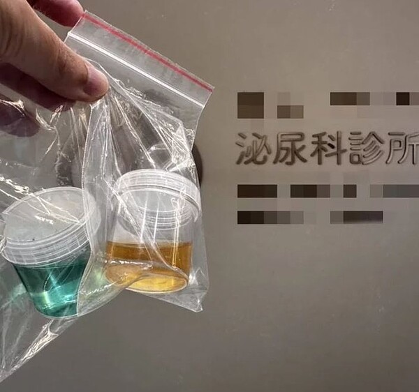 一名台商因為服用含亞甲基藍的藥物,尿液顏色呈現藍綠色。圖/截取自泌尿科呂謹亨醫師 - 大亨醫師粉專