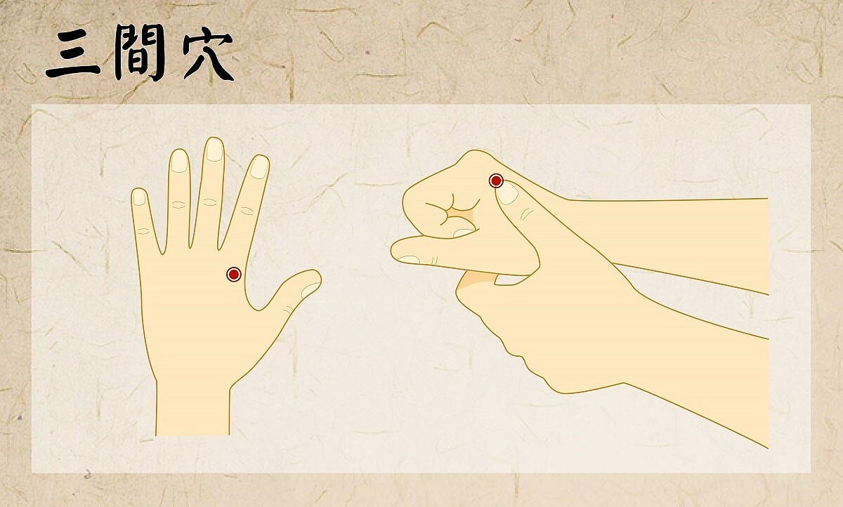 三間穴。圖/北市聯醫提供