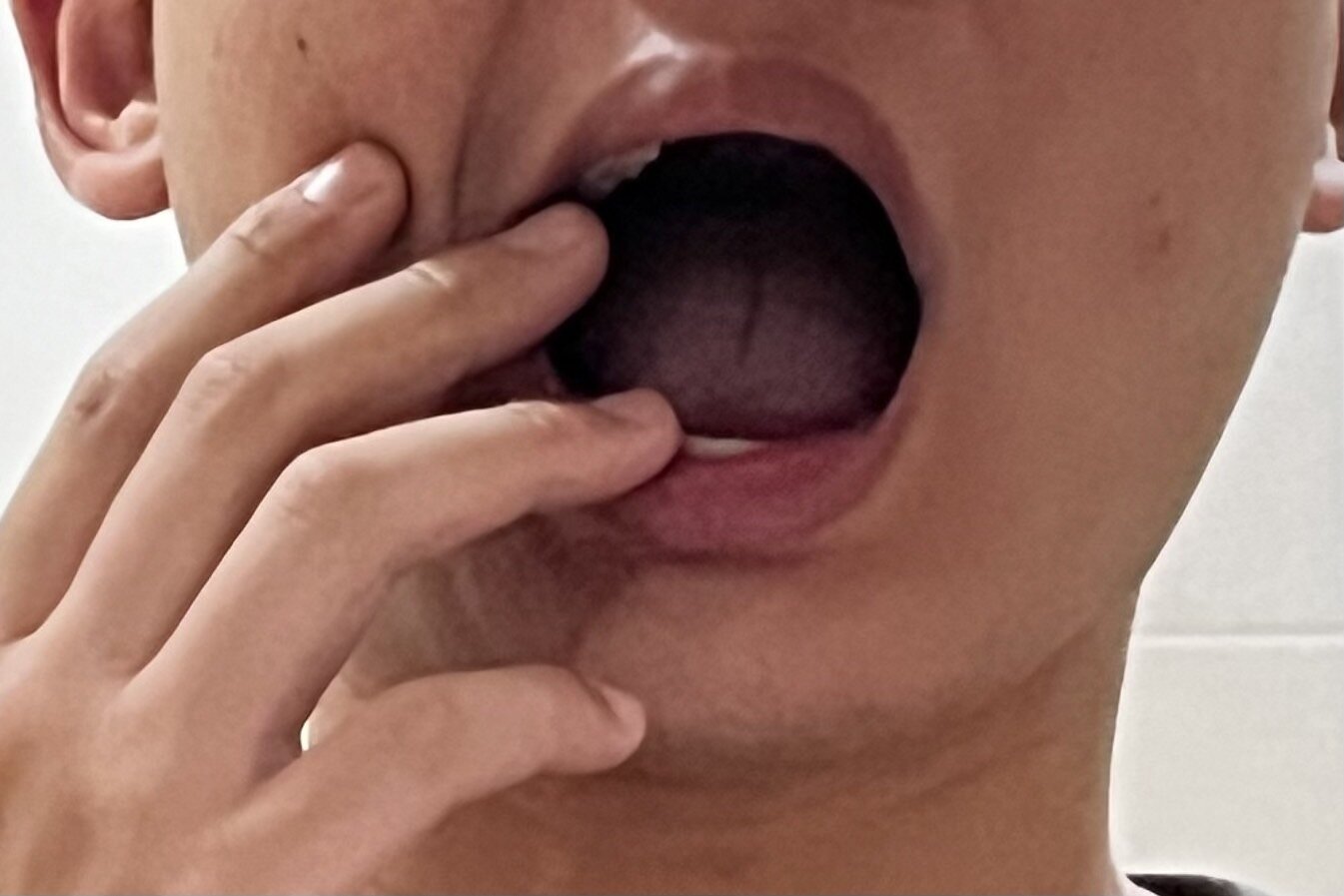 季節交替之際,民眾常出現嘴破情形。董氏基金會食品營養中心主任許惠玉指出,嘴破的原因多樣,僅以幫助傷口癒合來看,可吃深綠色蔬菜、糙米、燕麥等食物補充維生素B,促進黏膜健康。圖為示意圖。本報資料照片