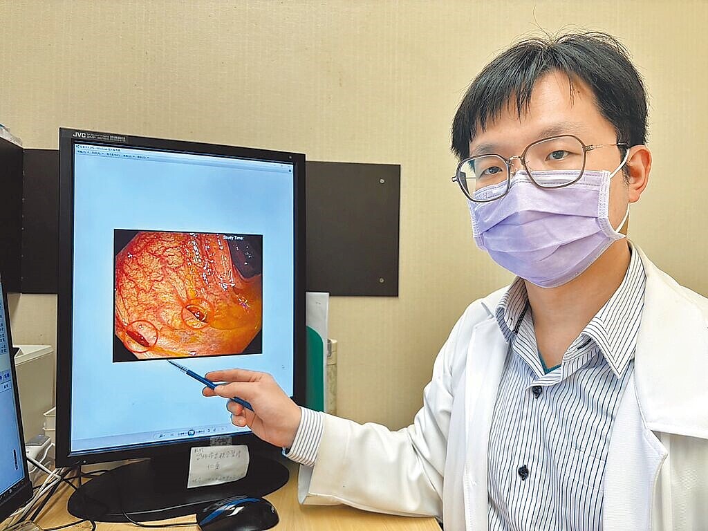 書田診所胃腸肝膽科主任醫師康本初表示,臨近過年,民眾聚餐次數增多,飲食容易比以往油膩、蔬果攝取少,導致便秘更嚴重,要小心「大腸憩室炎」。(書田診所提供)
