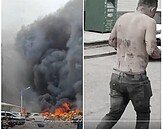 大陸山西社區發生大爆炸！　民眾渾身是血衝出火場　已知17傷、4重傷