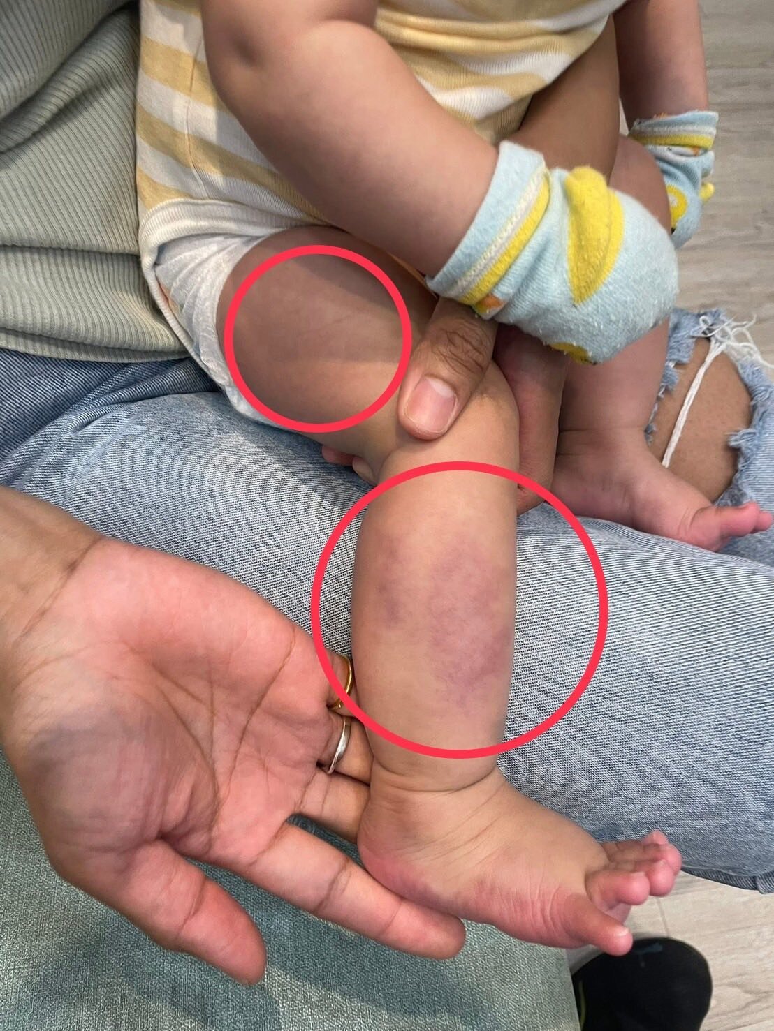 該名家長表示，原先對保母極為信任，甚至因其專業背景而毫無疑慮，沒想到發生疑似虐待事件。圖：截自黃瓊慧臉書